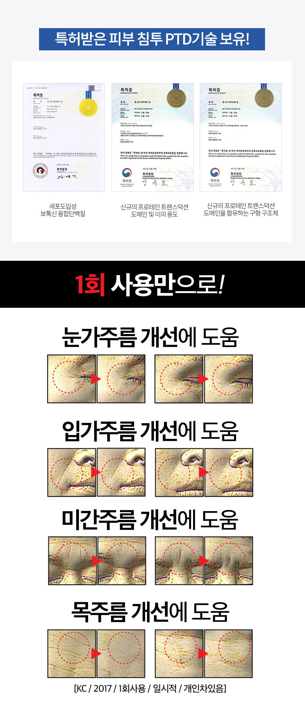 [MEDITIME] Botalinum Ampoule 30ml
