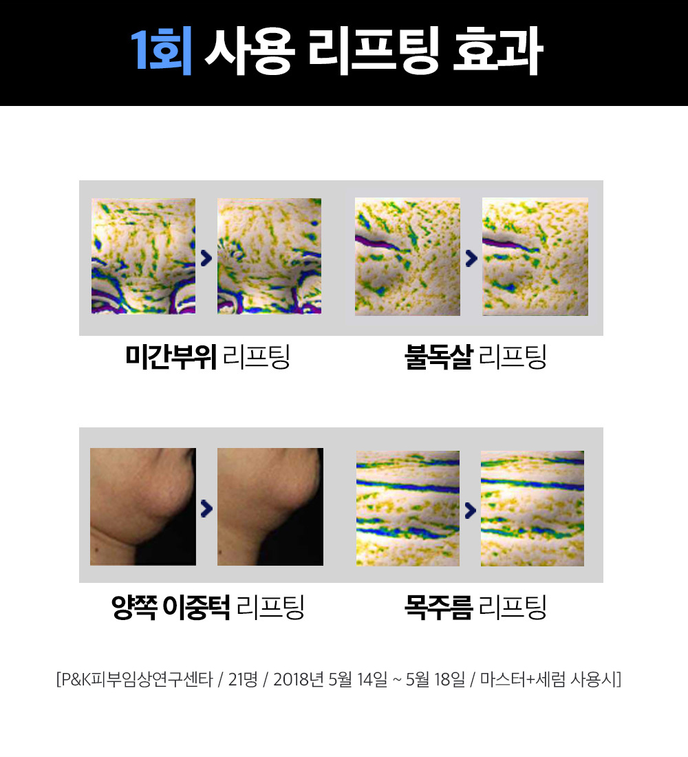 [MEDITIME] Batoxin Derma Lift-up Serum